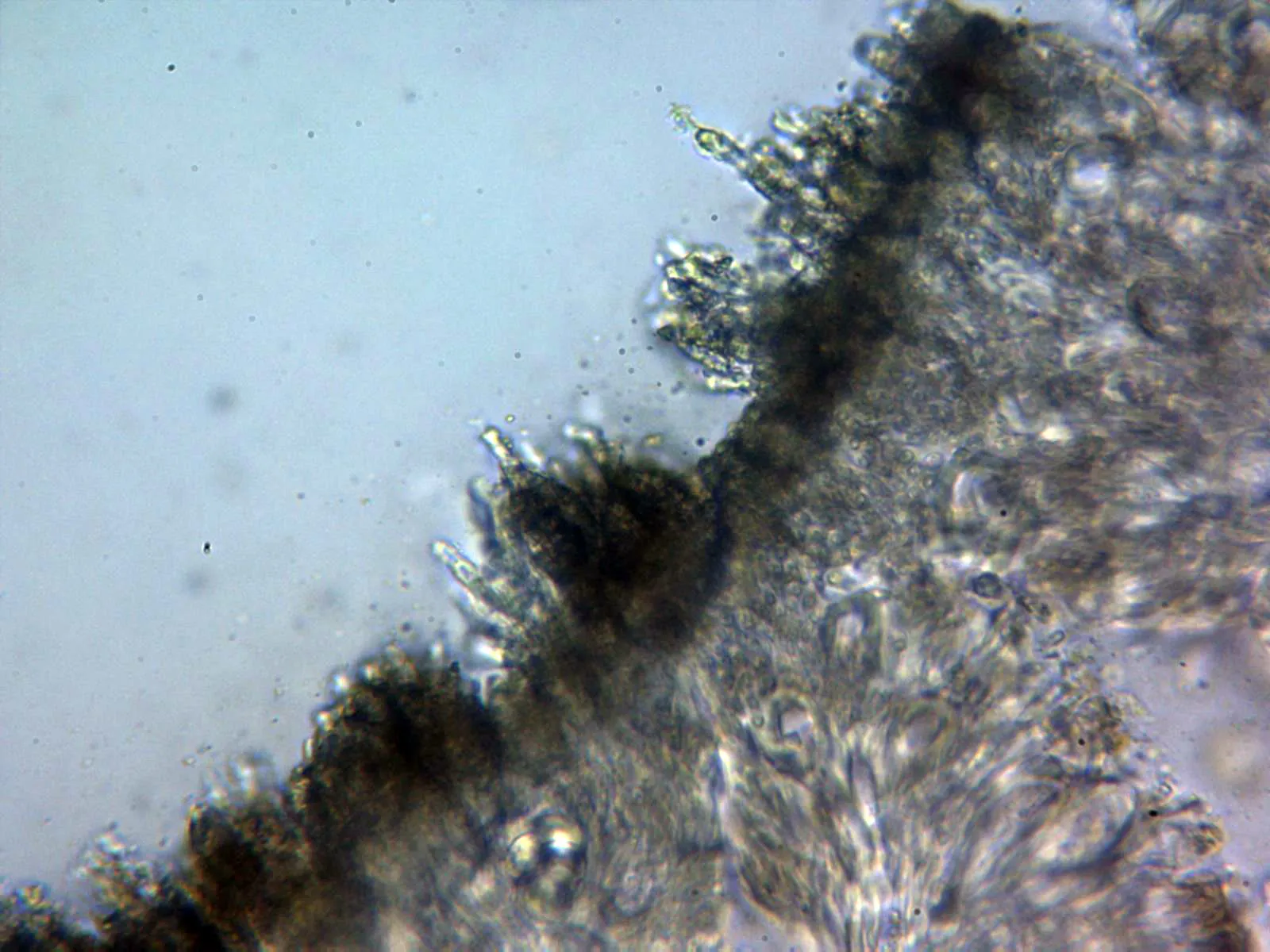 Microscopía de Lecanora chlarotera - 15 - Borde externo agua x 400